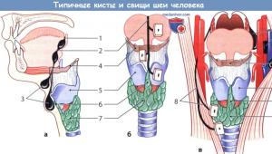Symptome einer lateralen Halszyste (Kiemenzyste) und ihre Behandlung Mediane Halsfistel mkb 10
